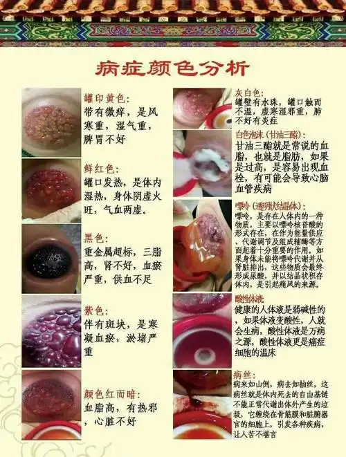 其它 48穴位截根拔出 寒湿毒 写美篇1,"虚"的感觉是怎么样?