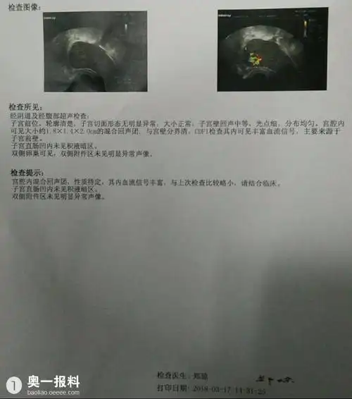 一个月让我做3次流产,我想院方给我一个解释医生又建议办理住院做宫