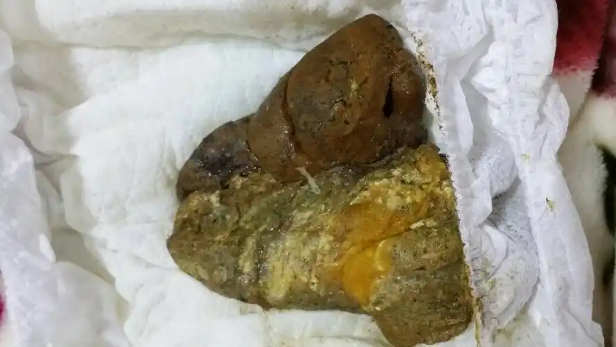 什么问题,这几天便秘都是拉一粒一粒,今天拉多点就这样.(我女儿