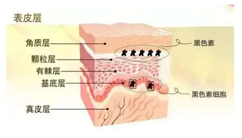 【女神养成计】皮肤基础知识--黑色素 第8期在线收听_新时代之声 女神