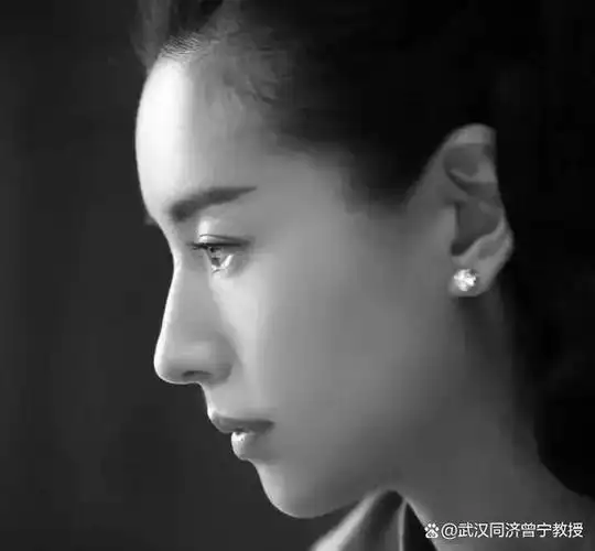 这套鼻整形模板必须收藏,看完你就知道哪种鼻子适合你了!