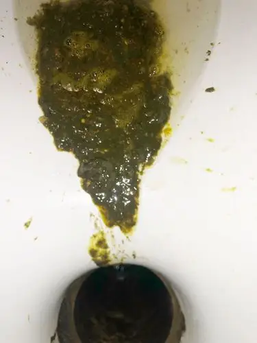 这个大便颜色和你吃的东西有关,吃青菜就是黑色的,胡萝卜就是有点黄