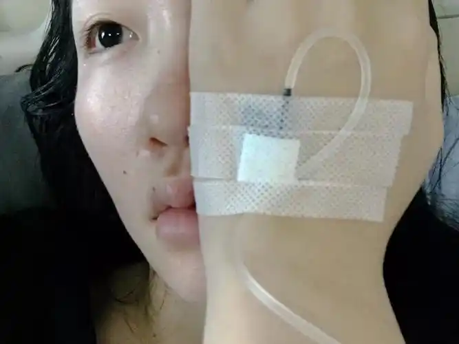 我的自拍,每天手上都插着针头.