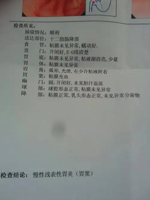 胃穿孔保守治疗后,4个月后照胃镜说胃窦