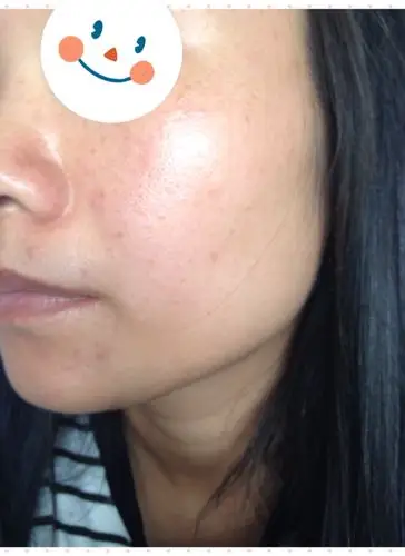 请高手来指点,我26岁生了宝宝了,混合型皮肤,有时有点小敏感!