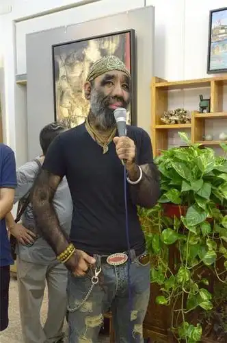 "毛孩"于震寰:出生就被研究,42岁娶90后娇妻,今生活令人羡慕