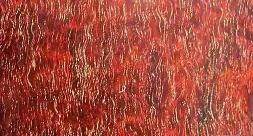 知道牛毛纹分5种吗?不知道别"瞎说"