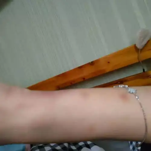 被男朋友打到满手臂淤青报警有用么