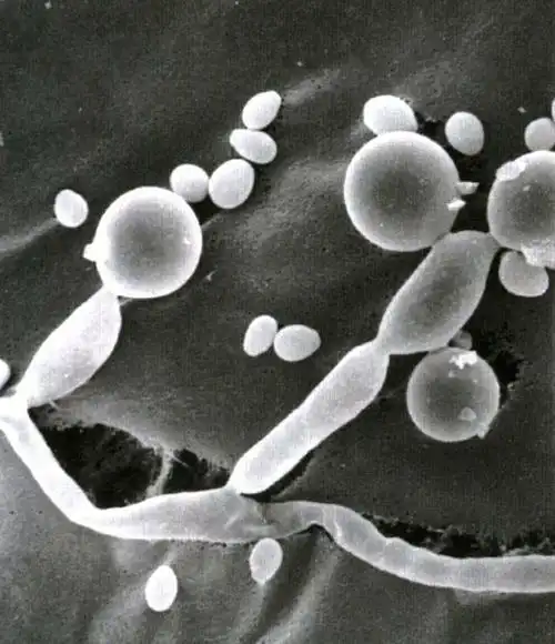 白色念珠菌和都柏林念珠菌鉴别