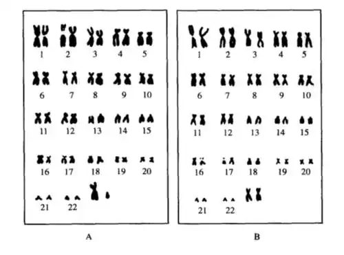 流产后有必要做流产物染色体检查吗?