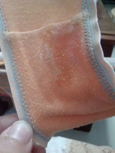 我15岁,今天月经又来了,内裤上发现了这个,这是不是白带呀?