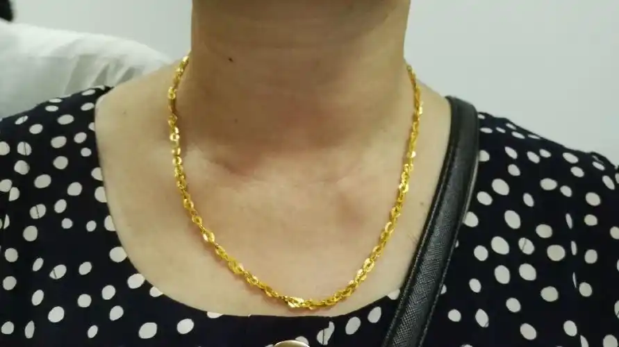 甲状腺手术颈部切口及疤痕 (图) 颈部无疤痕的腔镜手术