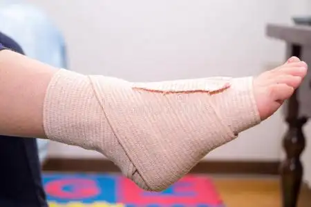 脚部用绷带包扎脚伤,脚扭伤,脚踝扭伤照片