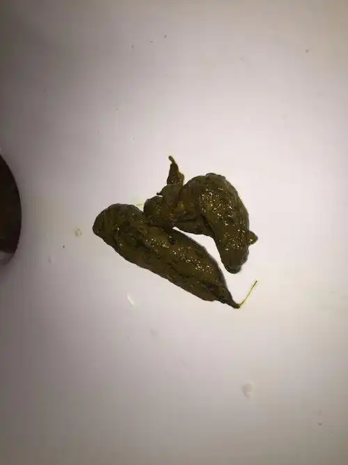 本人患有慢性浅表性胃炎和和伴有胆汁反流,还会有其他地方出现问题吗?