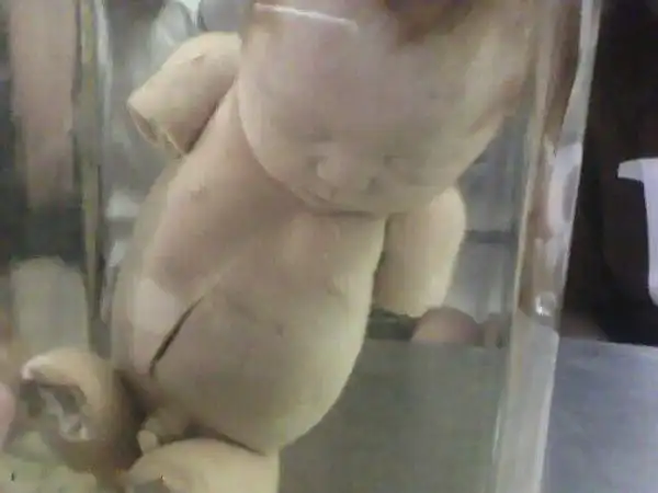 实拍医学院的婴儿标本 献身医学研究(怪异组图)