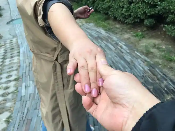 牵手,我们一起努力,预防卒中,我们永远在路上!