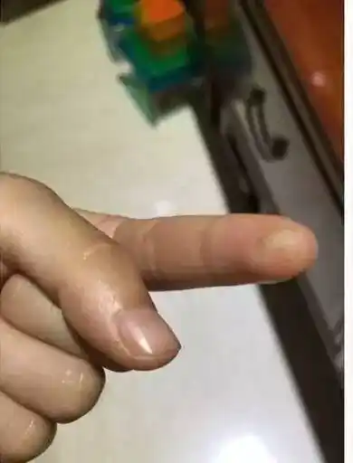 第三次是最近一次,她去摸驾驶位的点烟器,结果把手指给烫黑了