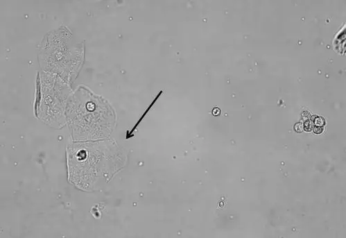 2018细胞形态学培训考试答案版