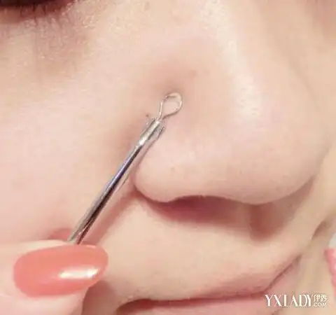 >> 文章内容 >> 挤黑头有什么方法 用手挤黑头有什么危险吗?问:?