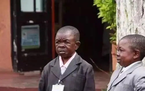 世界上最矮的人