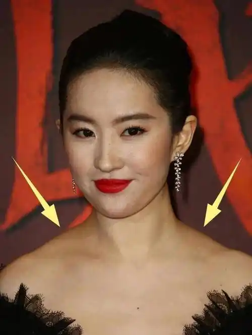 刘亦菲吴谨言这样的顶级美女都败给了肩膀厚斜方肌太厚怎么办