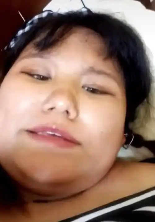 180斤女网红被男友家暴分手后甩80斤接着又整容如今大变样