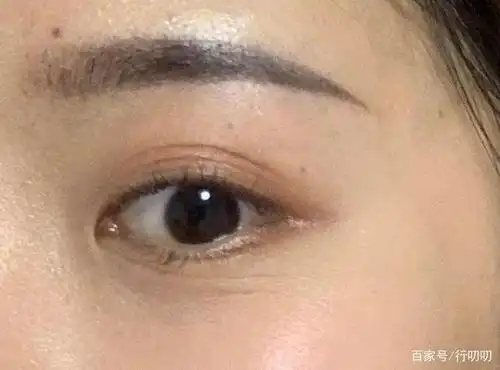 我才24岁,为什么眼下这么多细纹啊?