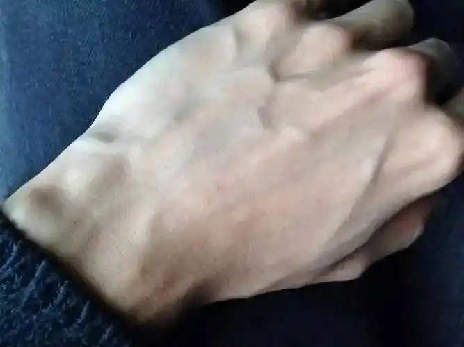 有的人手臂"青筋暴起",有的人几乎看不到青筋,哪种更健康呢?