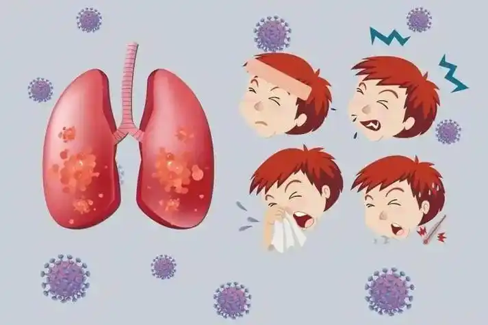 5岁以下儿童病毒性肺炎最常见病因_腾讯新闻