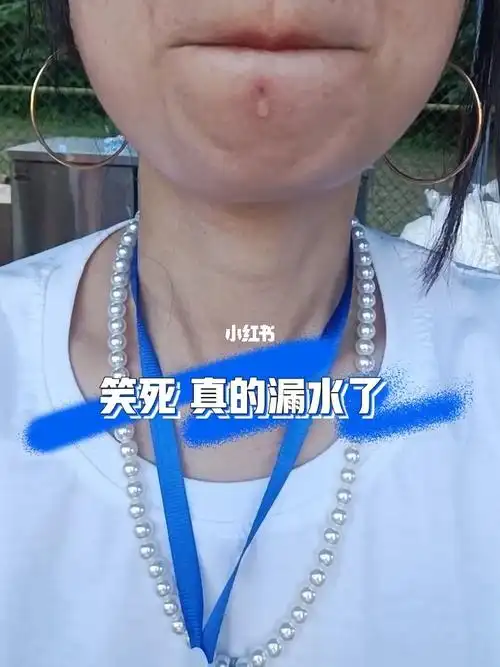我的唇钉孔真的漏水了