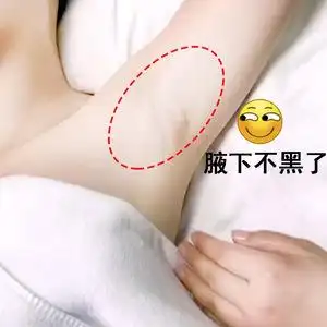 小红书推荐～腋下去黑美白～腋窝胳肢窝黑色素去除美白～买一送一