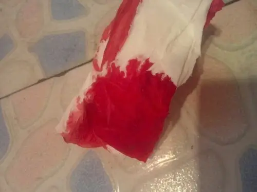 不是说正常的是暗红色吗?