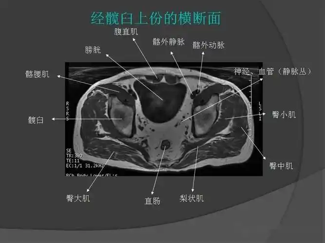 骨盆肌肉mri断层解剖