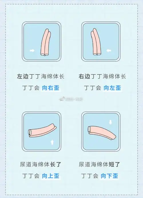 建议有性生活的男生都看看,丁丁有没有这个问题!