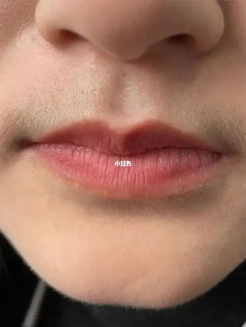 第一次脱唇毛试水成功