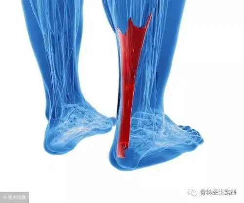 跟腱,也就是老百姓口中的"脚筋","大筋".