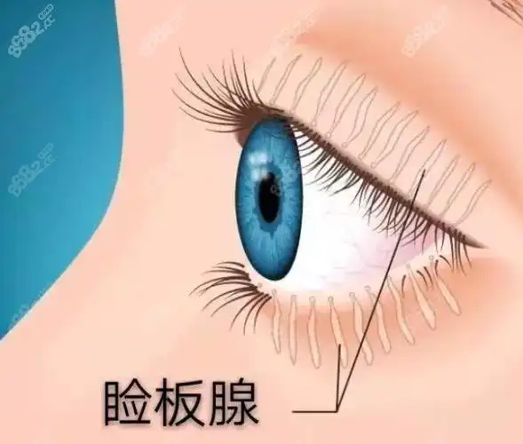 双眼皮睑板腺