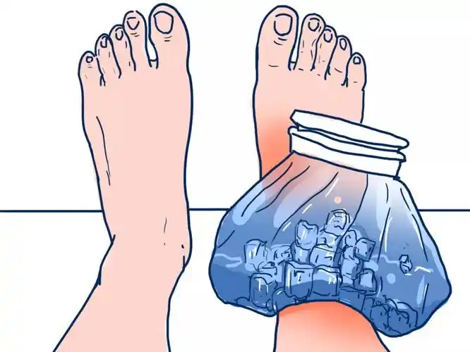 脚踝扭伤,千万不要这么做
