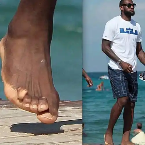 巨星背后的辛酸,詹姆斯脚趾照片意外走红,每年修脚花费60万_科比