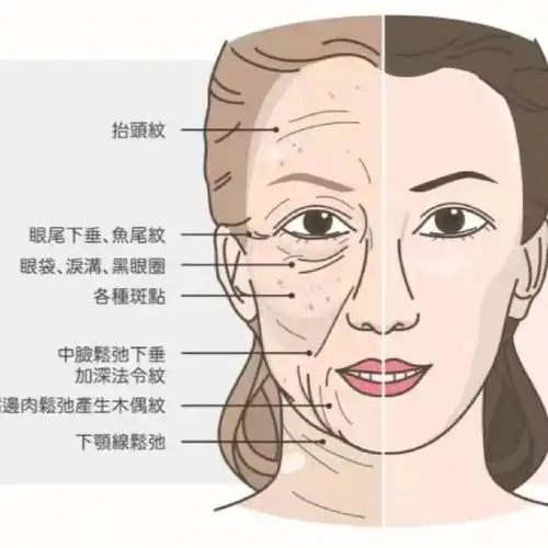 年轻的脸vs老化的脸