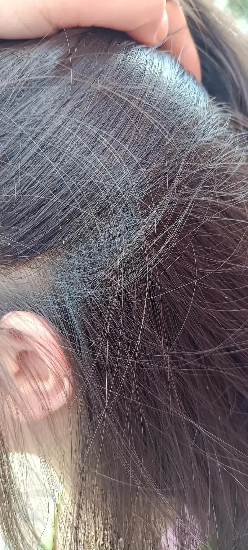 救命啊!四个月不见孩子,头上长满了虱子,我从来没见过虱子,见 - 抖音