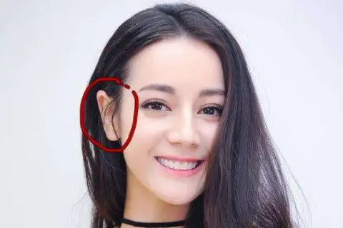 女人有招风耳有福气吗?