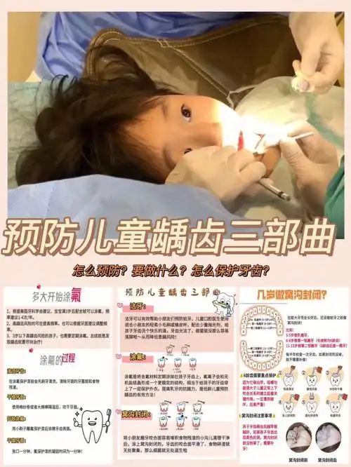 用牙线等,目前市面上最流行的护牙方法就是涂氟和窝沟封闭啦～有的