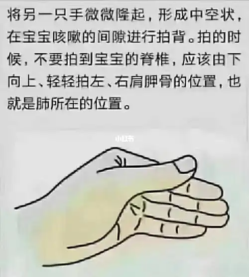 拍背排痰法--清晨效果最佳