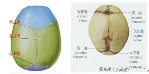 正常人颅骨上有很多条骨缝,常见的是前后的矢状缝和额缝,两侧对称生长