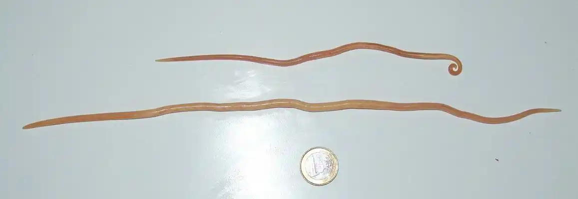 儿童肚子蛔虫图片 (26)_有来医生