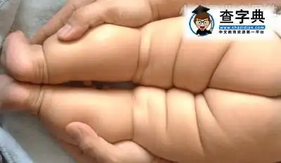 孩子腿纹不对称 妈妈要当心
