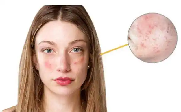 网易首页>网易号>正文申请入驻>敏感肌肤的保湿,呵护肌肤:敏感性的