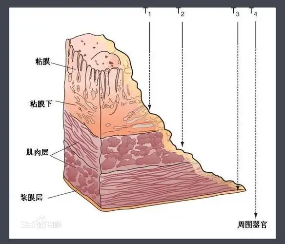 胃壁的生理功能胃壁最里层是黏膜层,厚度占胃壁的一半,上面布满小褶皱