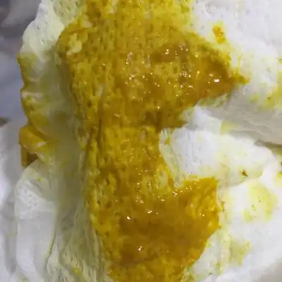 宝宝的大便正常吗?